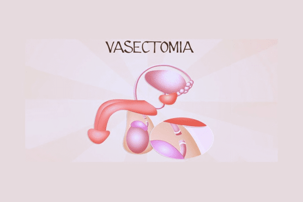Imagem ilustrativa de um pênis destacando a vasectomia
