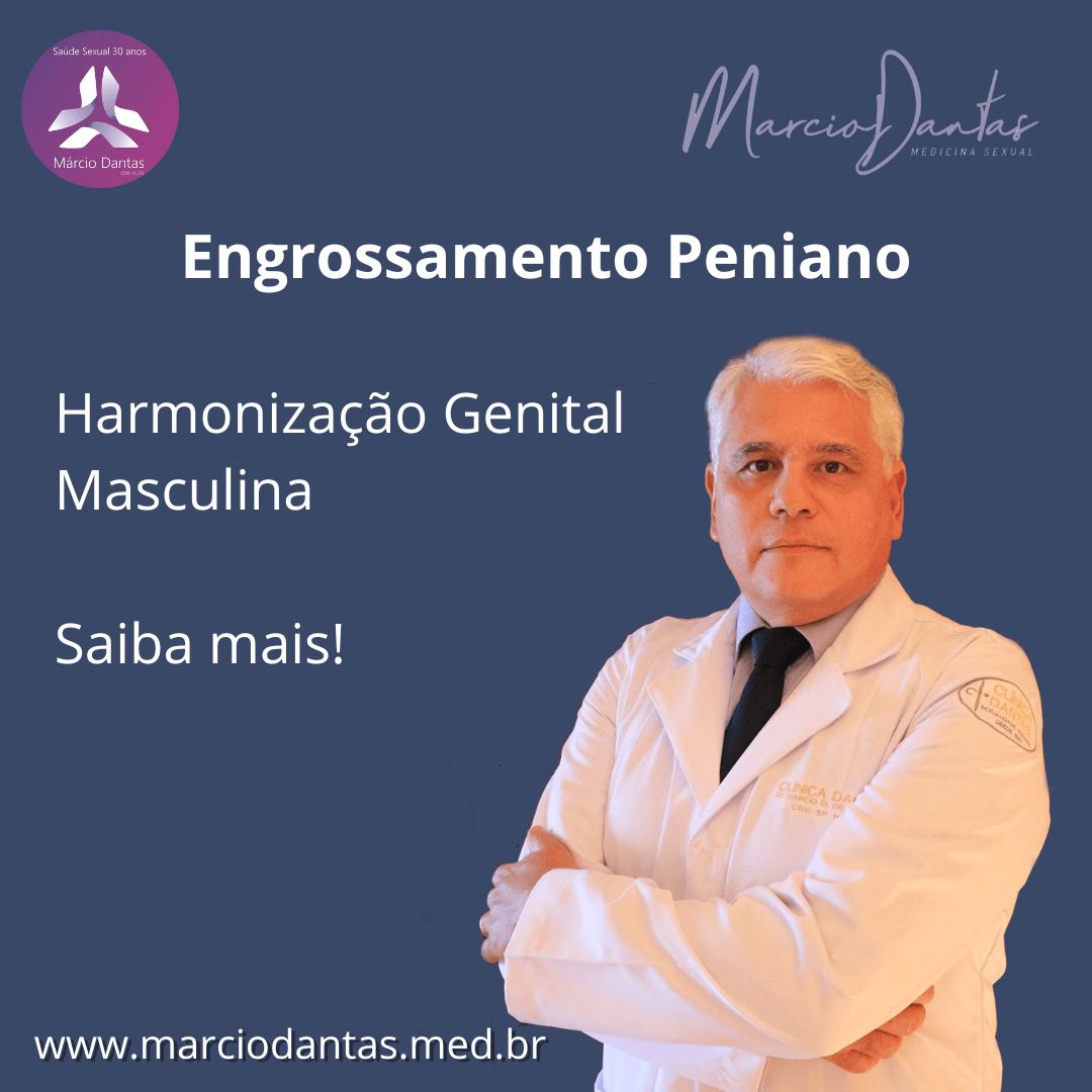 Engrossamento Peniano para Harmonização Genital Dr. Marcio Menezes