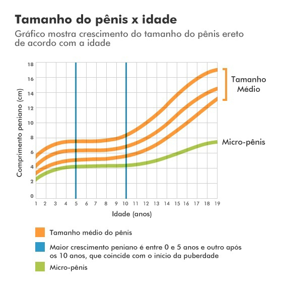 grafico