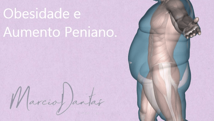 Imagem ilustrativa de uma pessoa obesa