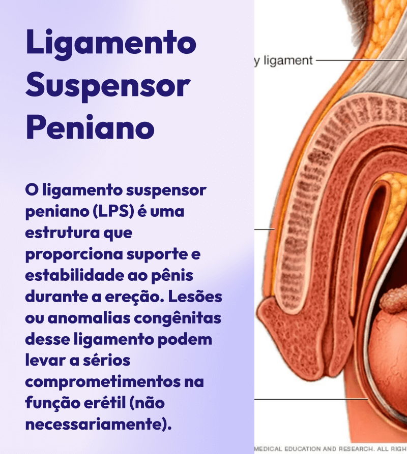 Ligamento-Suspensor-Peniano-Dr. Marcio Dantas de Menezes