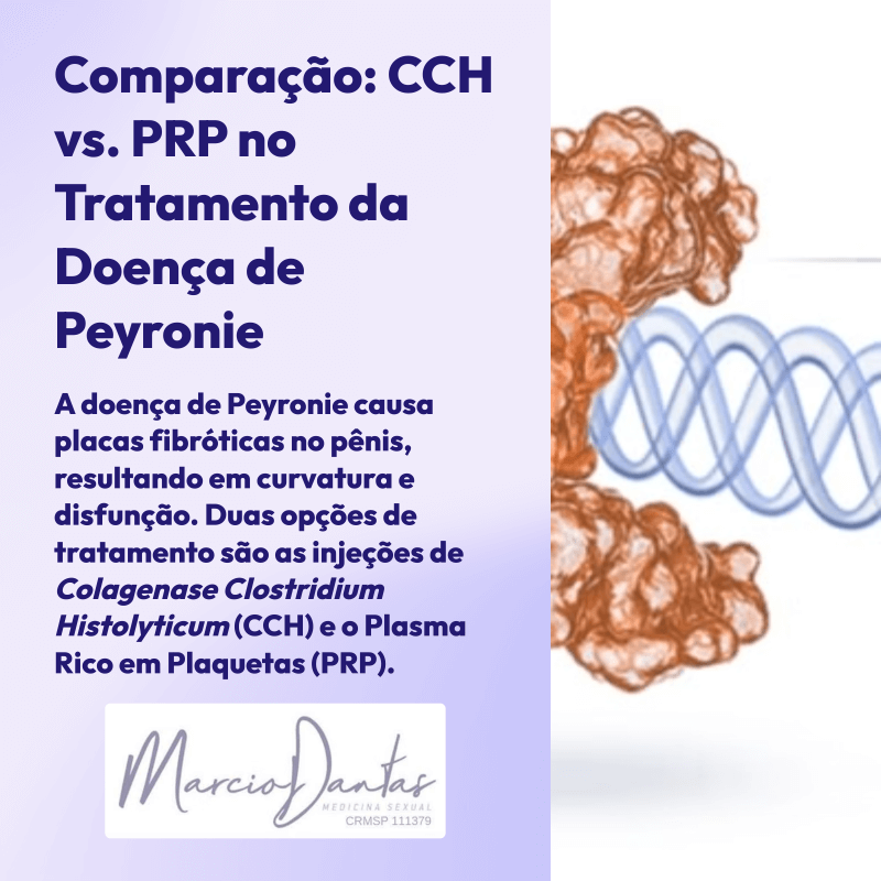 CCH vs. PRP no Tratamento da Doença de Peyronie Dr. Marcio Dantas de Menezes Curvatura Peniana