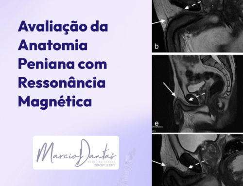 Avaliação da Anatomia Peniana com Ressonância Magnética